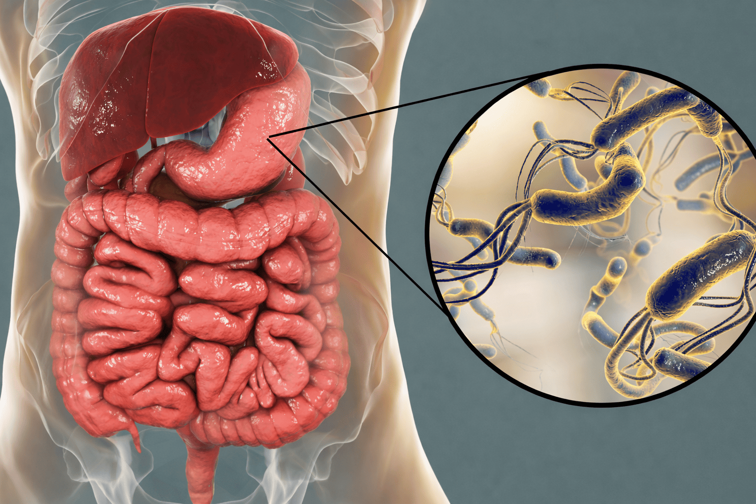 H pylori The Silent Bacteria Behind it all